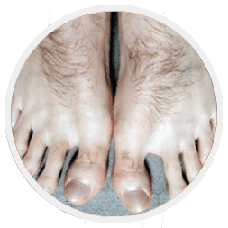 foot-hair-removal