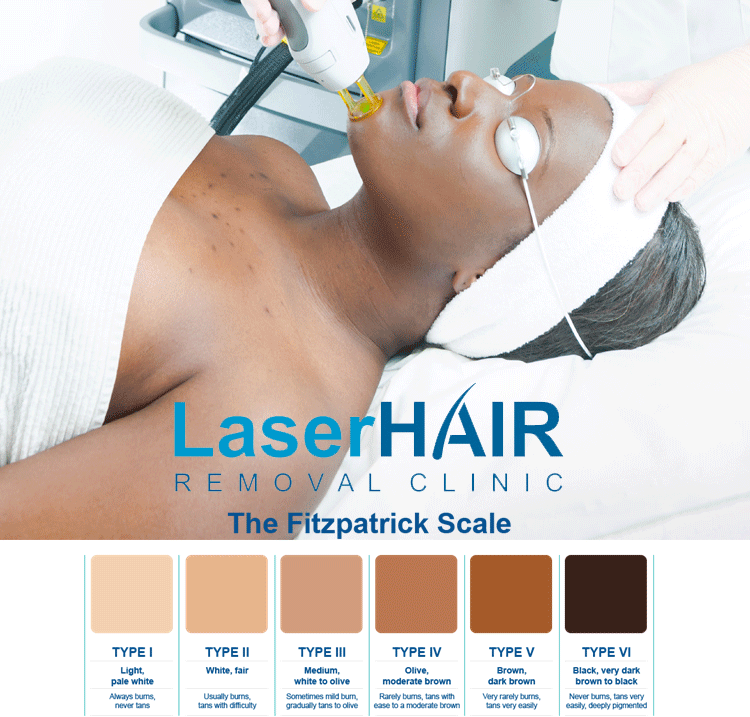 laser-hair-removal-for-dark-skin-Toronto