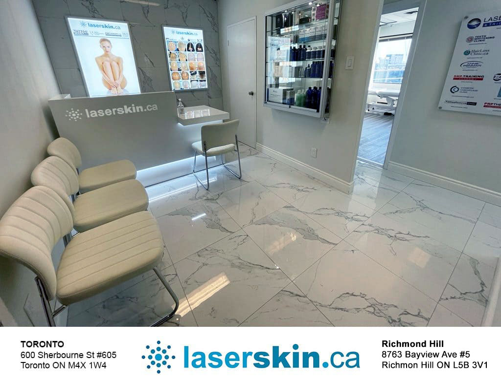 laser hair removal near me - laser hair removal Toronto
